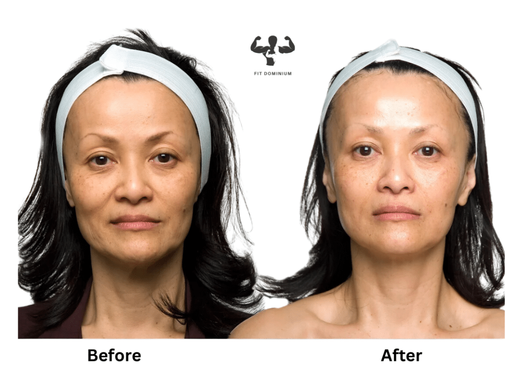 Red Light Therapy Before And After: The Results – FitDominium